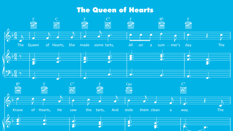 Image for Queen of Hearts – Sheet Music